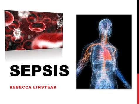 sepsis ppt for nurses